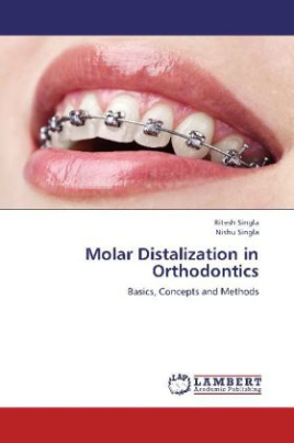 Molar Distalization in Orthodontics
