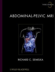 Abdominal-Pelvic MRI, 2 Vols.