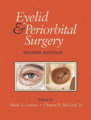 Eyelid and Periorbital Surgery, w. eBook