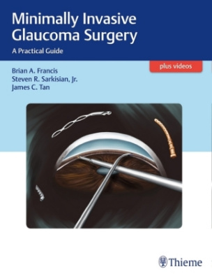 Minimally Invasive Glaucoma Surgery