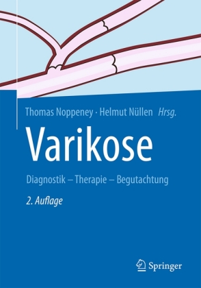 Varikose