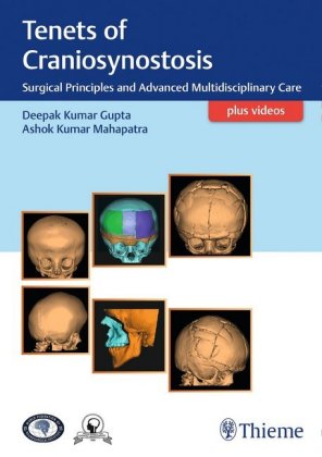 Tenets of Craniosynostosis