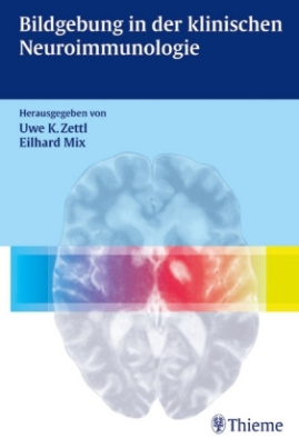 Bildgebung in der klinischen Neuroimmunologie