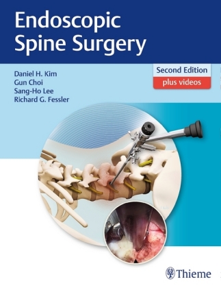 Endoscopic Spine Surgery