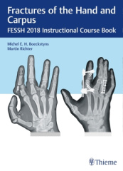 Fractures of the Hand and Carpus