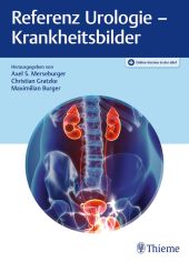 Referenz Urologie - Krankheitsbilder